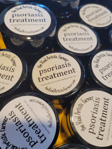 Psoriasis Treatment Salve